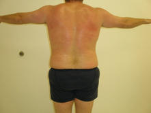dt a 3 Before and After Gallery
