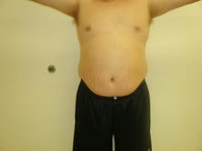 joem b 1 Before and After Gallery