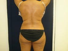 johm b 3 Before and After Gallery