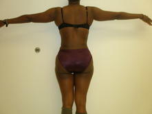 maca a 3 Before and After Gallery