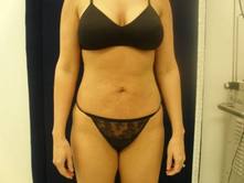 trdr a 1 Before and After Gallery