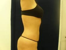 trdr a 2 Before and After Gallery